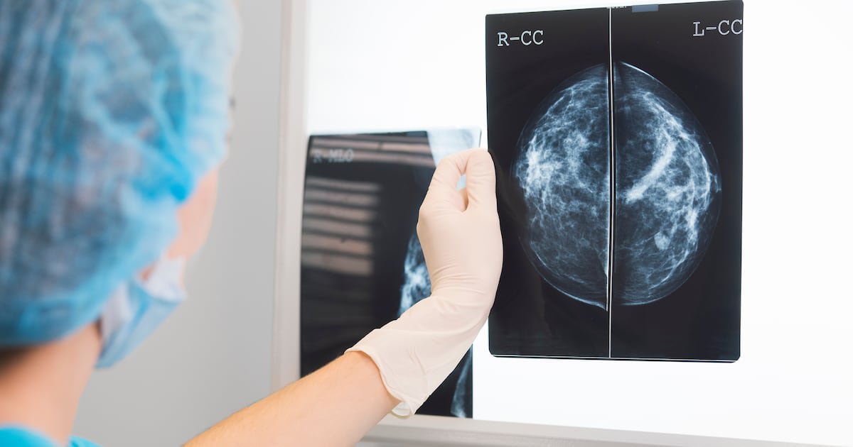 27-Year Danish Study Finds Women With Type 2 Diabetes Face Double the Cancer Risk